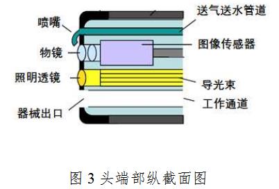 電子上消化道內窺鏡注冊技術審查指導原則(2020年第87號)(圖3) 電子上消化道內窺鏡注冊技術審查指導原則(2020年第87號)(圖3)